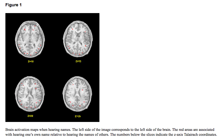 Via NIH 